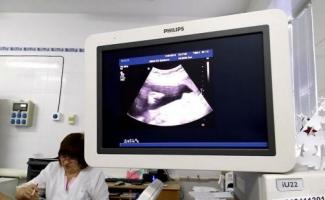 Как выглядит снимок узи. Узи для беременных. Как формируется пол будущего ребенка