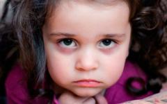 Причины мешков под глазами у ребенка и их устранение